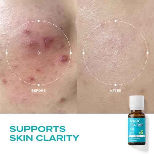 ? Magic Tea Tree Oil for Face, Clarifying Facial Oil for Oily & Sensitive Skin, Lightweight Daily Care with Tea Tree, Skin-Balancing Vegan Korean Skincare, 0.7 fl oz