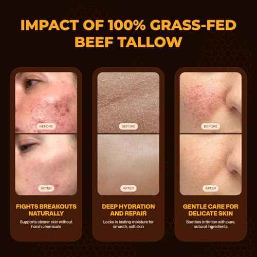 VIORY Tallow and Honey Balm for Face, Beef Tallow for Skin, Moisturizer with 100% Organic Grass-Fed Beef Tallow & Raw Wild Honey - Natural Formula for Dry & Sensitive Skin (Unscented)