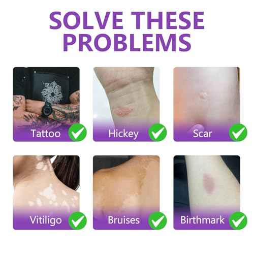 Tattoo Cover Up Makeup, Waterproof & Sweatproof Tattoo Concealer, Long-Lasting for Tattoos, Scars, Spots, Vitiligo, 2 Colors