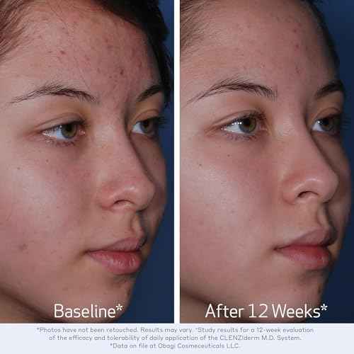 Obagi CLENZIderm M.D. Daily Care Foaming Acne Cleanser ? Acne Treatment with 2% Salicylic Acid (BHA)