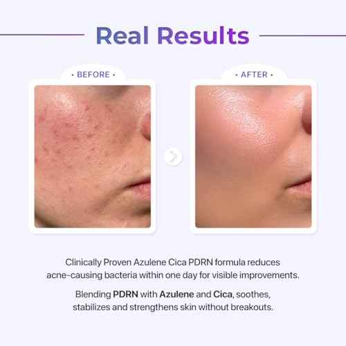 Le Nubele Azulene Cica PDRN Fiber Light Serum 01, Salmon DNA PDRN 2,000ppm, Peptide, Panthenol, Skin Restoration, Barrier-Repair, Hydrating & Firming, Korean Skin Care, 30ml/1.01 fl.oz.