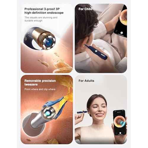 BEBIRD Earsight Plus Ear Wax Removal Tool Camera with HD Visual Otoscope, Smart WiFi Earwax Cleaner Kit, Safe Silicone Flexible Scoops & Tweezers Tools for Adults & Kids (Blue)