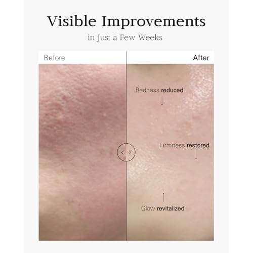 Nuborn Cell Placenta Stem Cell Intensive Repair Cream | Dragon Blood Cream with Placental Extract | Collagen Korean Skin Care for Glass Skin (50ml)