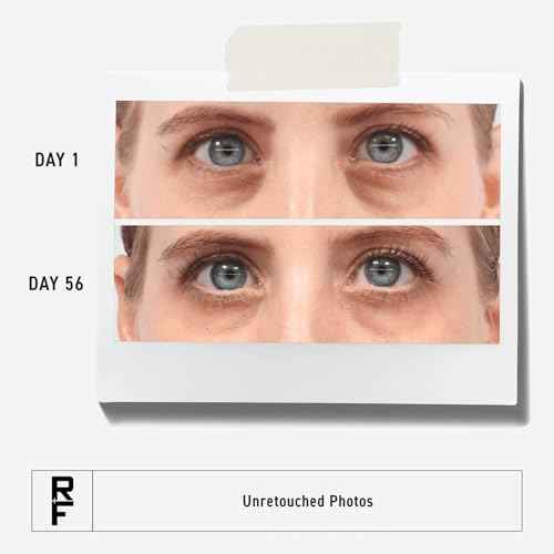 RODAN + FIELDS Active Hydration Bright Eye Complex | 15ml | Moisturizing Under Eye Cream for Dry Skin | Eye Treatment for Refreshed Appearance | Skincare