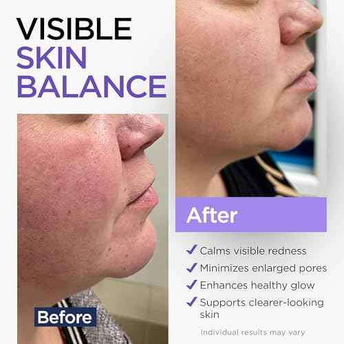 Niacinamide Serum for Face 10% with Zinc 1% Vitamin B3 Anti-Aging, Advanced Skin Care for Even Tone, Texture and Hydrating Cruelty Free 2 Oz