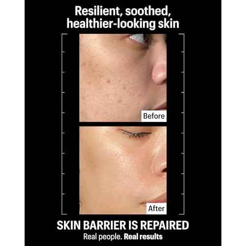 Allies of Skin Molecular Barrier Repair Cream Balm | Deeply Hydrating Face Moisturizer with Ceramides & Squalane | Daily Treatment to Soothe Irritated Skin | For Post-Procedure and Dry Skin | 1 fl oz