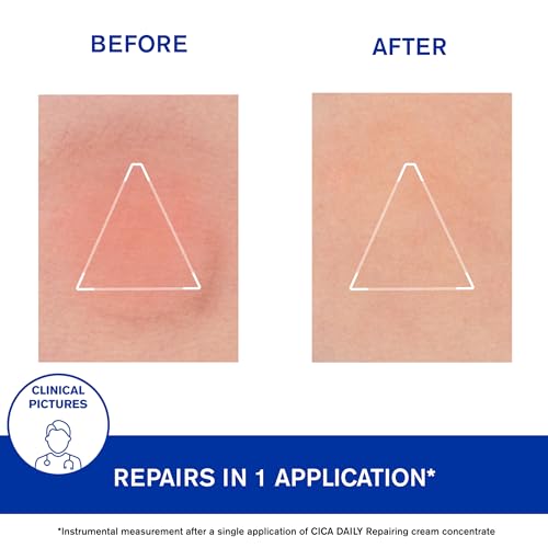 URIAGE Cica-Daily Repairing Gel-Cream for Face | Made With Prebiotic, Centella Asiatica & D-Panthenol, Ultra-light gel, Paraben & Fragrance-Free, Non-comedogenic, 40 mL / 1.35 oz