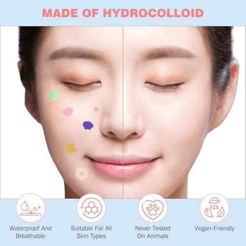 Pimple Patches for Face 280PCS, Hydrocolloid Acne Patches for Covering Zits and Blemishes, Cute Star Pimple Patches, Facial Skin Care Products.