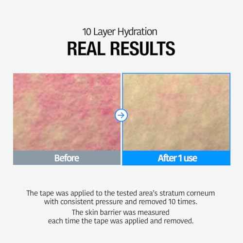 GOODAL Heartleaf Hyaluron Soothing Toner - Trouble Care, Korean Skin Care, Soothing, Moisturizing, Hydrating, Calming Skin, Instant Cooling, Hyaluronic Acid,Ceramide (11.83 fl.oz.)
