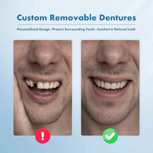 Custom Removable Dentures ? Personalized Partial Denture Set for Tooth Replacement | 1?Multi-Tooth Coverage with Storage Case | Comfortable Wear for teeth (1 Tooth)