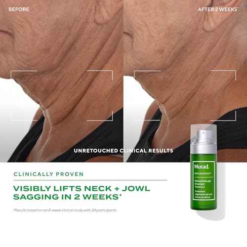 Murad Retinal ReSculpt Overnight Treatment - Advanced Face and Neck Serum with Encapsulated Retinal, Kangaroo Paw, Olive, & Oat Smooths Deep Wrinkles and Crepey Skin, & Lifts Sagging Skin