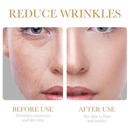 Collagen Skin Care Set, 6Pcs Anti Aging Face Care Sets for Women, Firming Skin, Shrink Pores, Smooth Wrinkles, Hydrating Skin Care Set Include Serum Face Cream Eye Cream Toner Cleanser Facial Mask1