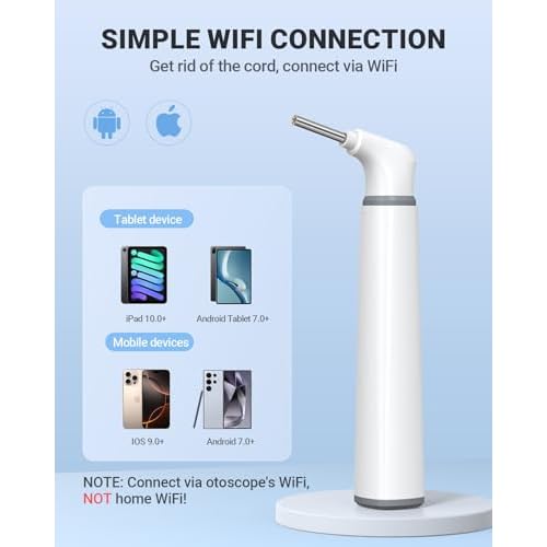 Wireless Otoscope with Gyroscope, Ear Camera with Dual View, 3.9 mm Otoscope with Light, Ear Scope with Ear Wax Removal Tool for Kids, Adults, and Pets, Compatible with iPhone and Android