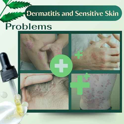ABERA Alan Silver Serum ? Botanical Hydrating Serum for Dry & Sensitive Skin & Herbal Extracts ? Daily Moisturizer for Face, Body & Scalp ? Fast Absorbing, Lightweight ? (2 boxes)