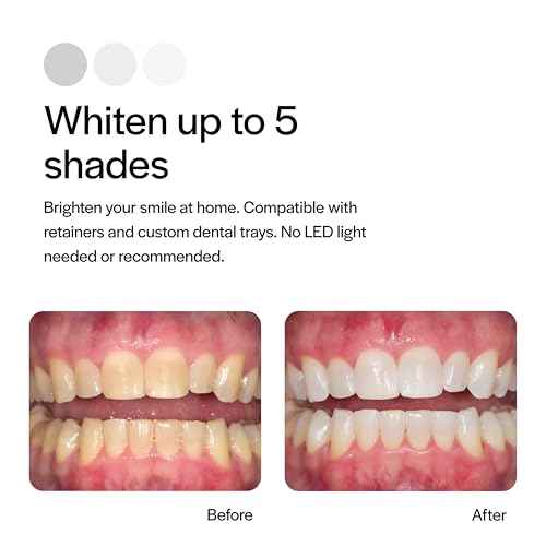 Opalescence 10% Teeth Whitening Kit - Gel Syringes Refills - Low Sensitivy (8 Units) - Fluoride, Carbamide Peroxide - Made in The USA by Ultradent 5211-4