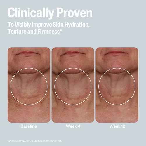 Cetaphil Skin Activator Hydrating & Firming Body Cream 12oz, Mandelic Acid (AHA) and Centella Asiatica (CICA) Cream, Hydrates and Firms Aging Skin, Anti-Aging Skincare, 12 oz