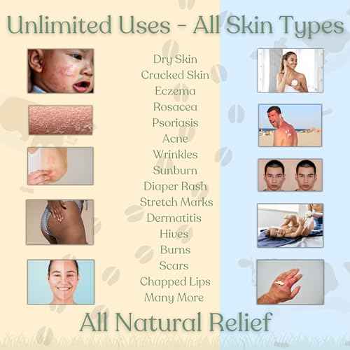 Beef Tallow Balm for Skin | NAKED TALLOW BALM | 1 Ingredient - 100% Grass Fed Tallow | Whole Body & Face Moisturizer | Whipped & UNSCENTED for Sensititve Dry Skin, Babies, Eczema, Psoriasis, Rosacea (2oz)