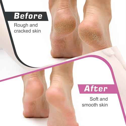 Electric Foot Callus Remover,Callus Remover for Feet,with 60pcs Sanding Disc,Electric Speed Adjustable Foot File for Dead Skin Cracked Skin Calluses for Men and Women