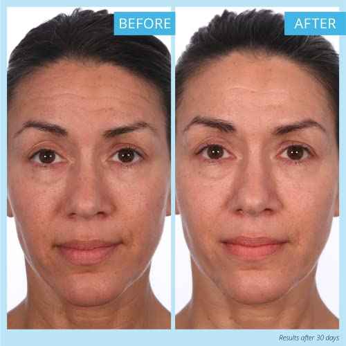 SKINN Cr?me Reverse with Ferulic Acid, Retinol and Vitamin C-Cr?me Reverse Intensive-Anti-Aging Cream with Hyaluronic Acid to Plump Skin Vitamin C Help to Improving Tone, Firmness of Skin