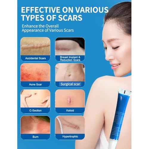 Silicone Scar Gel, Advanced Scar Cream treating for New and Old Scars, Surgical Scars, Burn Scars, Stretch Marks, Acne Scars, Dark markings, Keloid Removal 0.70 oz (20 g)