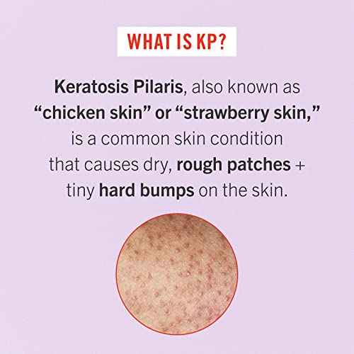 First Aid Beauty - Smooth Operators Trio: KP Bump Eraser Body Scrub, 8 oz, Smoothing Lotion, 6oz, and Ingrown Hair Pads, 28 Pads, Deep Moisture Exfoliating Skin Treatment Set with BHA & AHA, 3ct