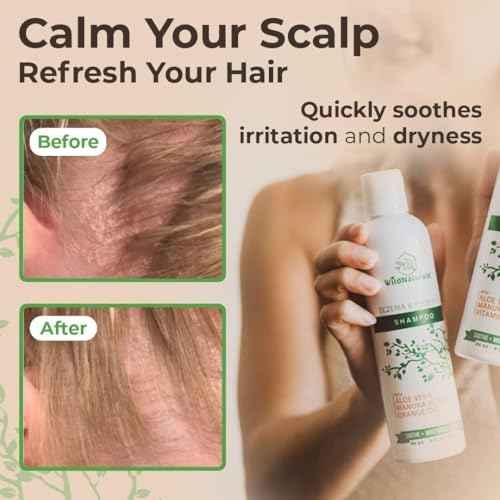 Eczema & Psoriasis Treatment Shampoo - Anti-Dandruff, Scalp Relief for Dry & Itchy Skin - Hypoallergenic, Paraben & Fragrance-Free for Sensitive Scalp