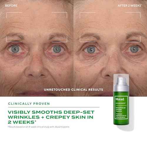 Murad Retinal ReSculpt Overnight Treatment - Advanced Face and Neck Serum with Encapsulated Retinal, Kangaroo Paw, Olive, & Oat Smooths Deep Wrinkles and Crepey Skin, & Lifts Sagging Skin