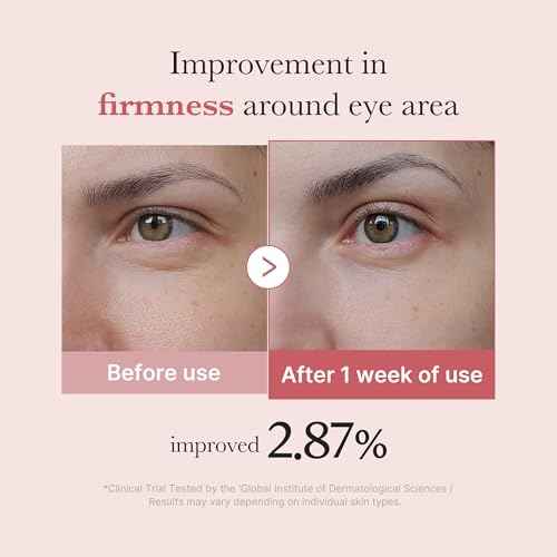 medicube Salmon DNA PDRN Pink Peptide Eye Serum with Niacinamide and 99% Purity Retinol for Fine Lines, Uneven Skin Tone, Korean Skin Care 1.01fl.oz