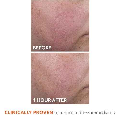 Dr Dennis Gross DermInfusions Blur + Repair Cream, Instantly Blurs Fine Lines, Smooths Skin with Satin-Matte Finish, Visibly Plumps & Firms, Reduces Redness, and Improves Skin Elasticity, 1.7 Fl Oz