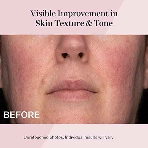 Advanced Retinol-Parent