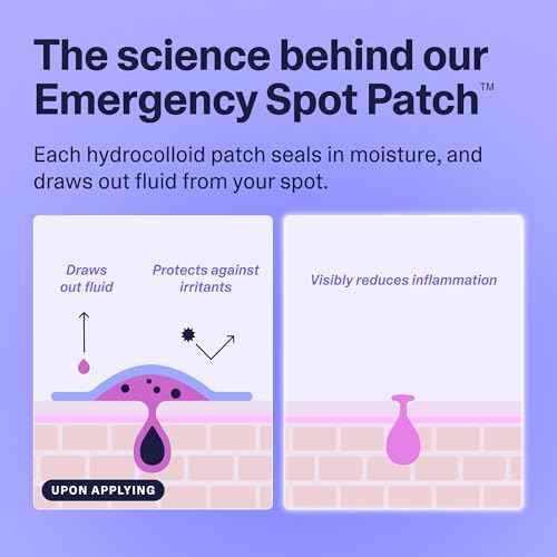 Curology Emergency Spot Pimple Patches for Face, Stocking Stuffer Gifts, Hydrocolloid Pimple Patches Fast-Acting, 80 Count