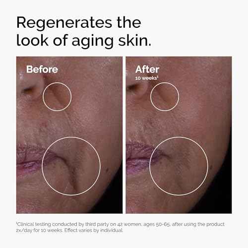 The Ordinary GF 15% Solution, Anti-Aging Formula for Visible Skin & Wrinkle Repair, 1 Fl Oz