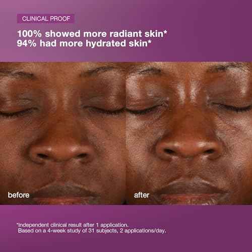 Dermalogica MultiVitamin Power Recovery Face Cream, Hydrating Facial Moisturizer with Antioxidants - Preventing Signs of Skin Aging, 1.7 fl oz