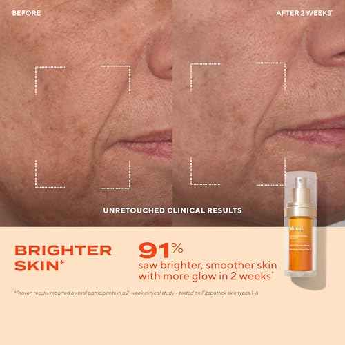 Murad Vita-C Glycolic Serum - Advanced Brightening Vitamin C and Glycolic Acid Face Serum for Improved Skin Tone and Texture - Gold-Stabilized Vitamin C for Enhanced Efficacy and Potency