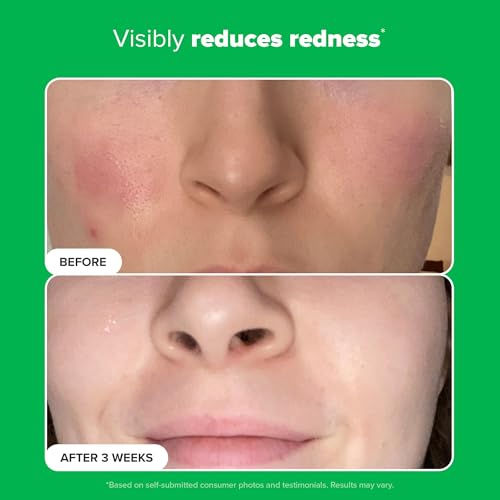 Paula's Choice BOOST 10% Azelaic Acid Booster Cream Gel Face Serum with Salicylic Acid, Oil-Free Skin Brightening Serum for Face, Fragrance-Free