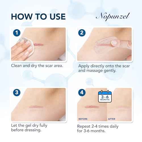 Silicone Scar Gel: Silicone Gel for Scars - Improve Scar Appearance for Old and New Scars - Medical Grade Silicone - Advanced Scar Gel - Scalds - Surgery - Injury - Stitches - Burns - 20g