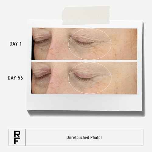 RODAN + FIELDS Redefine Eye Cream | 15 ml | Vitamin C & F Moisturizer for Hydrated, Radiant Eyes | Supports Younger Looking Eyes | Smooths Puffiness