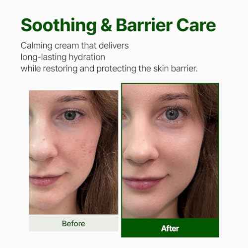 NACIFIC Cica PDRN Barrier Cream 1.76 oz 50g ? Centella Asiatica, Moisturizing, Strengthening Barrier Repair for Dry, Sensitive Skin, Calming Korean Skincare, Christmas Gifts for Women