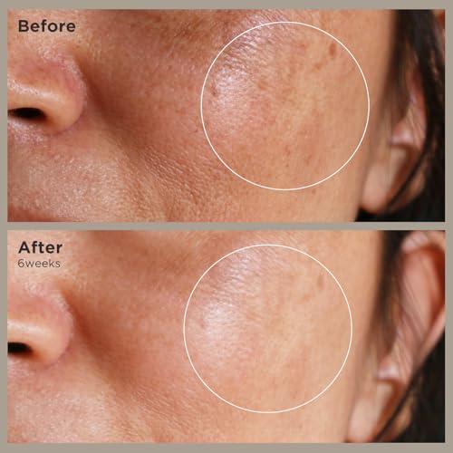BIOCHEM Nonapeptide-1 Brightening Serum?Dark Spot Corrector & Melanin Inhibitor Ampoule for Even Skin Tone & Natural Glow? Anti-Aging Peptide Treatment for Face & Neck,1.01 fl oz/30 mL