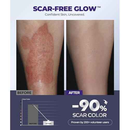 Silicone Scar Cream with 6.7% Active Ingredients, Scar Gel Visible in 2 Weeks, Moisturizing Scar Removal Clinically Show for Surgical, C-Section, Keloid, Acne & Burn Scars, Stretch Mark Cream(55ML)