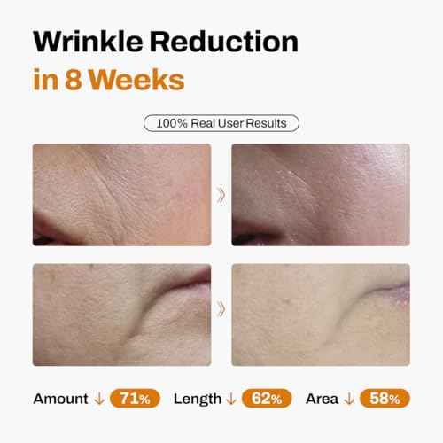 JEU'DEMEURE DermiShuttle Lifting Kit - Anti Aging Serum, Face Serum for Firming, Anti Wrinkle, Skin Elasticity, Hydrating with Collagen, Peptides, Korean Skincare (8 Weeks)