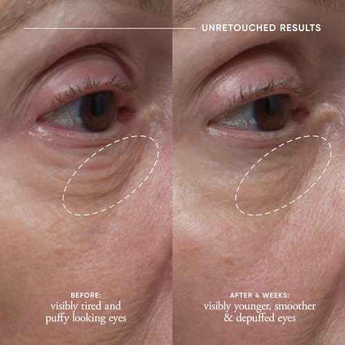 philosophy dose of wisdom bouncy skin reactivating facial serum - with hyaluronic acid, vitamin C & a patented vitality booster - delivers skin that is bouncy, plumped & radiant in one week