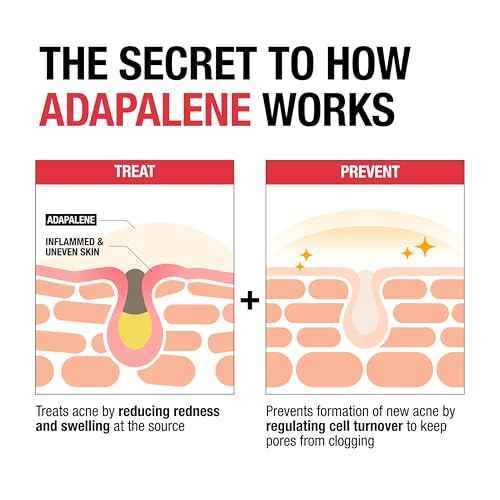 Neutrogena 0.1% Adapalene Gel Acne Treatment, Topical for Acne, Adapalene Medication for Blemishes, Once Daily Topical Retinoid to Prevent Breakouts, Oil & Fragrance-Free, 1.6 oz