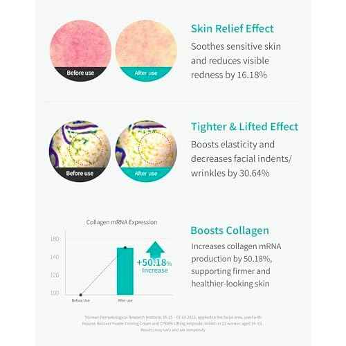 REJURAN¢ç Recover c-PDRN¢ç Lifting Ampoule - High Concentration Original PDRN Serum for Collagen Boost, Deep Hydration, Skin Soothing, Gentle Formula & Intensive Anti-Aging Korean Skincare. (2ml x 14)