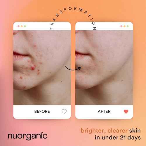 nuorganic Turmeric Face Mask - Soothing, Acne Clearing, Pore Refining, Exfoliating - New Airtight Squeezy Tube, Stays Fresh for 12 Months - Clean & Natural