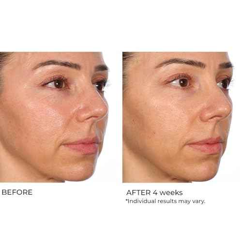NassifMD Hydro-Gel with Hylauronic Acid Moisturizer, Salicylic Acid Serum, Retinol Serum for Face