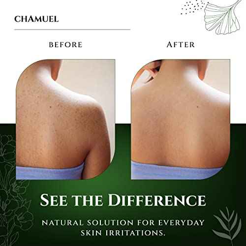 Chamuel Tea Tree Body Wash - Made With Natural Ingredients To Fights Itchy Skin, Body Odor, Athlete's Foot, Jock Itch & Toenails Issues - Organic Scented - Men & Women (11.8oz) 2-Pack
