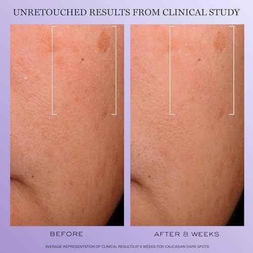 Lanc?me R?nergie H.C.F. Triple Serum - Hyaluronic Acid Serum for Visible Correction of Anti Aging Signs & Dark Spots - With Vitamin C+, Niacinamide & Ferulic Acid