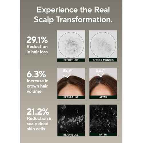 AROMATICA Rosemary Salt Scrub Shampoo - Hair Loss Korean Scalp Detox Shampoo with Rosemary Scalp Oil | Scalp Exfoliator with Salt Scrub for Oily Scalp | Sulfate Free, Silicone Free (10.5 oz / 300g)