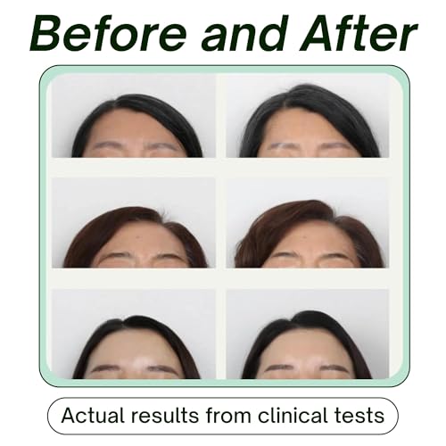 SRILabs KEEWEE Hair Growth Shampoo with Biotin, Niacinamide, Green Tea & Ginkgo ? Thickening for Thinning Hair & Hair Loss | Sulfate-Free, Color-Safe, Scalp-Calming